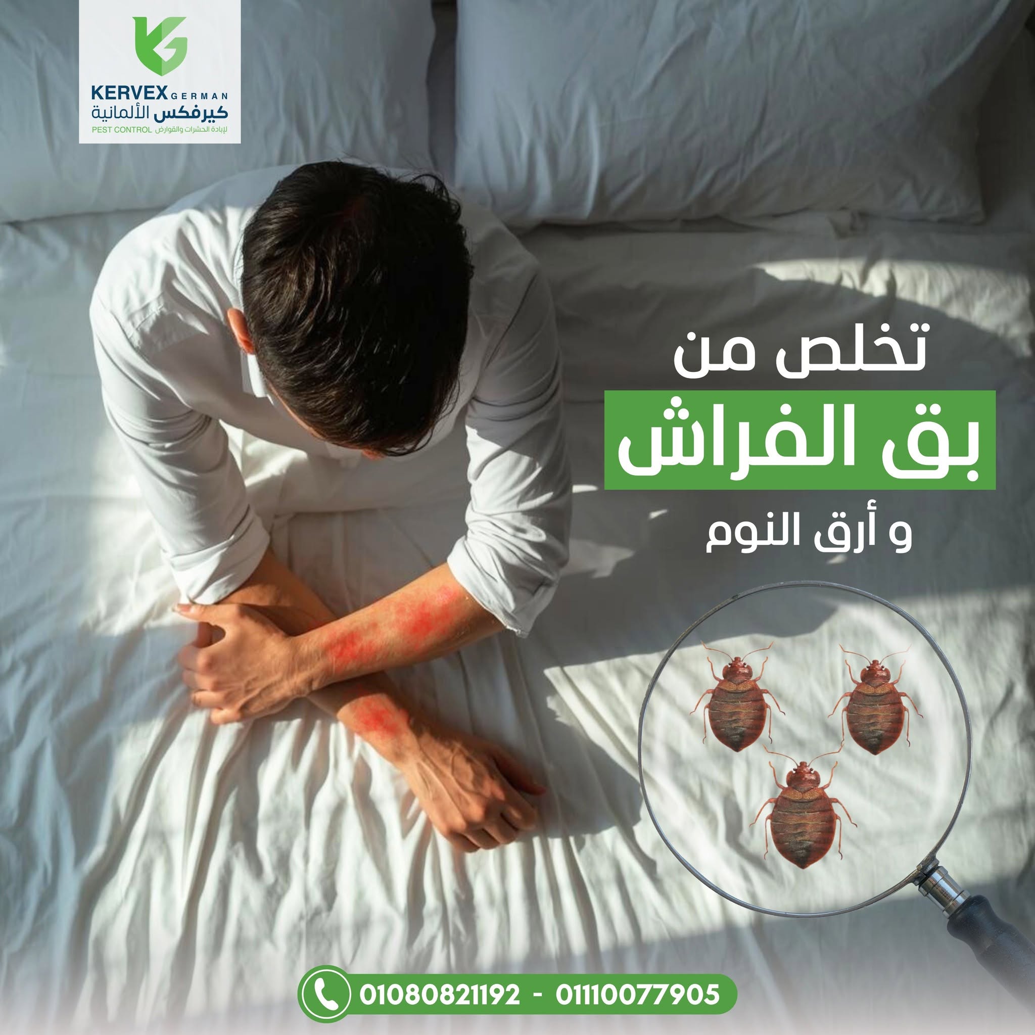 شركة إبادة البق في القاهرة | كيرفكس الألمانية